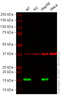 Western blot - Anti-Lysozyme antibody [SP329] (AB223503)