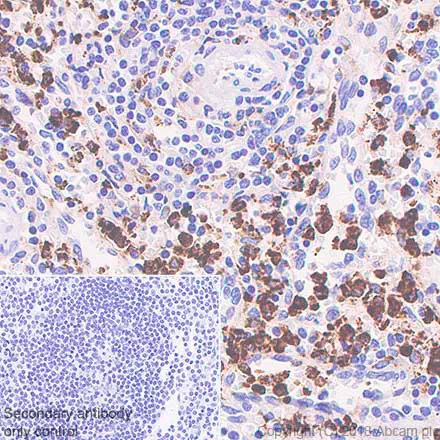 Immunohistochemistry (Formalin/PFA-fixed paraffin-embedded sections) - Anti-Lysozyme antibody [SP329] - BSA and Azide free (AB242420)