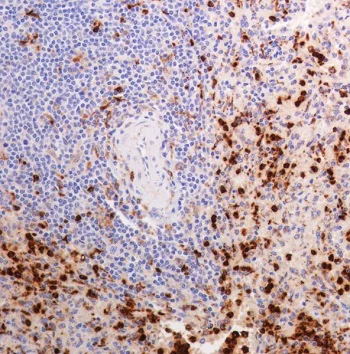 Immunohistochemistry (Formalin/PFA-fixed paraffin-embedded sections) - Anti-Lysozyme antibody [SP329] - BSA and Azide free (AB242420)