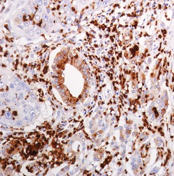 Immunohistochemistry (Formalin/PFA-fixed paraffin-embedded sections) - Anti-Lysozyme antibody [SP329] - BSA and Azide free (AB242420)