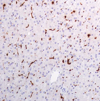 Immunohistochemistry (Formalin/PFA-fixed paraffin-embedded sections) - Anti-Lysozyme antibody [SP350] - BSA and Azide free (AB242430)