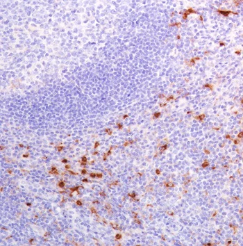 Immunohistochemistry (Formalin/PFA-fixed paraffin-embedded sections) - Anti-Lysozyme antibody [SP350] - BSA and Azide free (AB242430)