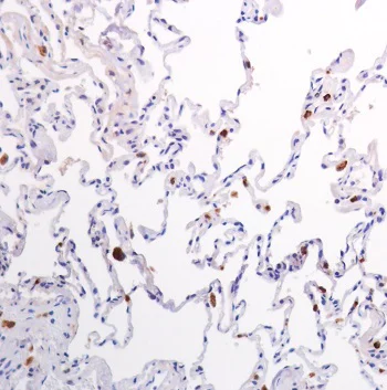 Immunohistochemistry (Formalin/PFA-fixed paraffin-embedded sections) - Anti-Lysozyme antibody [SP350] - BSA and Azide free (AB242430)