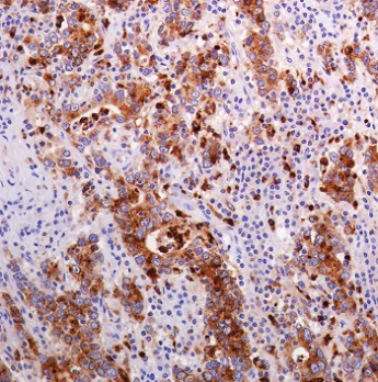 Immunohistochemistry (Formalin/PFA-fixed paraffin-embedded sections) - Anti-Lysozyme antibody [SP350] - BSA and Azide free (AB242430)