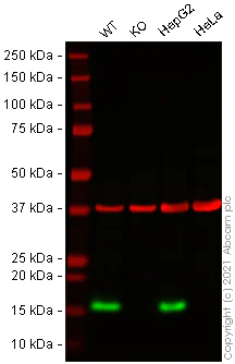Western blot - Anti-Lysozyme antibody [SP350] - BSA and Azide free (AB242430)