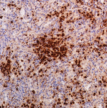 Immunohistochemistry (Formalin/PFA-fixed paraffin-embedded sections) - Anti-Lysozyme antibody [SP350] - C-terminal (AB227708)
