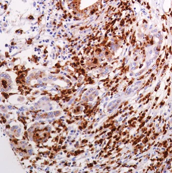 Immunohistochemistry (Formalin/PFA-fixed paraffin-embedded sections) - Anti-Lysozyme antibody [SP350] - C-terminal (AB227708)