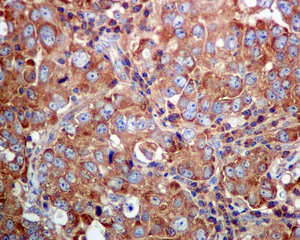 Immunohistochemistry (Formalin/PFA-fixed paraffin-embedded sections) - Anti-LysRS antibody [EPR7920] - BSA and Azide free (AB248725)