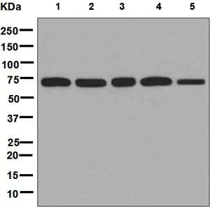 Western blot - Anti-LysRS antibody [EPR7920] - BSA and Azide free (AB248725)