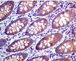 Immunohistochemistry (Formalin/PFA-fixed paraffin-embedded sections) - Anti-LysRS antibody [EPR7921] (AB129080)