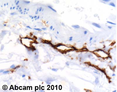 Immunohistochemistry (Formalin/PFA-fixed paraffin-embedded sections) - Anti-LYVE1 antibody (AB10278), expandable thumbnail