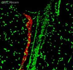 Immunohistochemistry (Frozen sections) - Anti-LYVE1 antibody (ab10278), expandable thumbnail