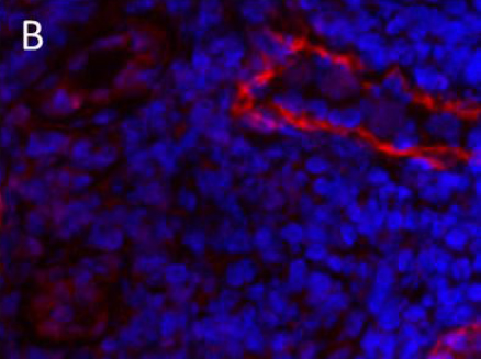 Immunohistochemistry (Frozen sections) - Anti-LYVE1 antibody (AB10278), expandable thumbnail