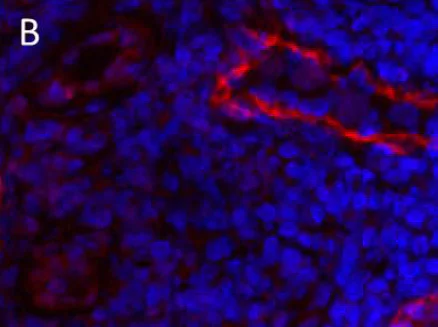 Immunohistochemistry (Frozen sections) - Anti-LYVE1 antibody (AB10278)