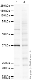 Western blot - Anti-LYVE1 antibody (AB10278), expandable thumbnail
