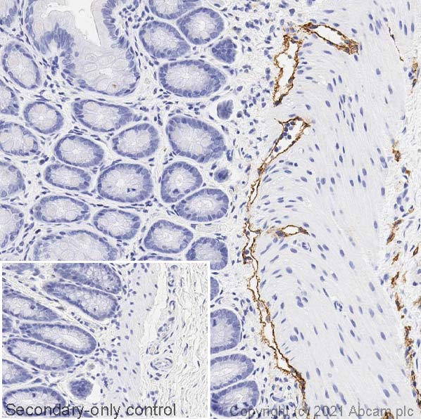 Immunohistochemistry (Formalin/PFA-fixed paraffin-embedded sections) - Anti-LYVE1 antibody (AB33682), expandable thumbnail