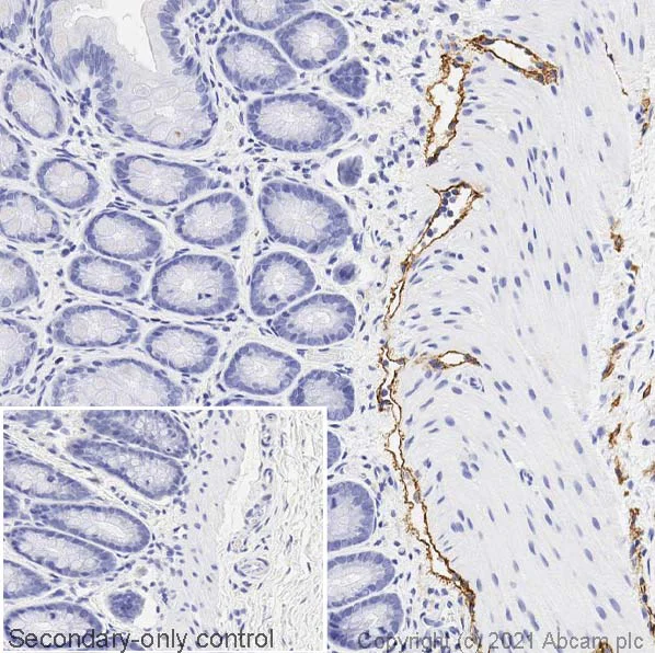 Immunohistochemistry (Formalin/PFA-fixed paraffin-embedded sections) - Anti-LYVE1 antibody (AB33682)