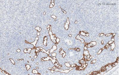 Immunohistochemistry (Formalin/PFA-fixed paraffin-embedded sections) - Anti-LYVE1 antibody (AB33682)
