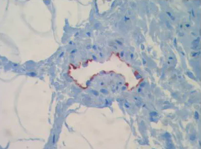Immunohistochemistry (Formalin/PFA-fixed paraffin-embedded sections) - Anti-LYVE1 antibody (AB36993)