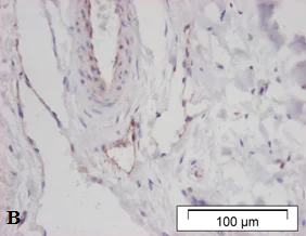 Immunohistochemistry (Formalin/PFA-fixed paraffin-embedded sections) - Anti-LYVE1 antibody (AB36993)