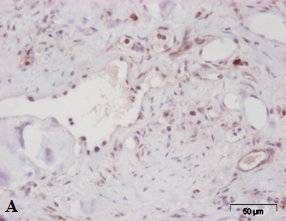 Immunohistochemistry (Formalin/PFA-fixed paraffin-embedded sections) - Anti-LYVE1 antibody (AB36993)