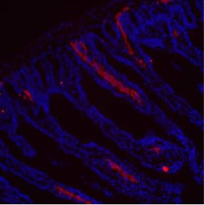 Immunocytochemistry - Anti-LYVE1 antibody - BSA and Azide free (AB14917), expandable thumbnail