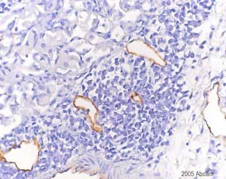 Immunohistochemistry (Formalin/PFA-fixed paraffin-embedded sections) - Anti-LYVE1 antibody - BSA and Azide free (AB14917), expandable thumbnail