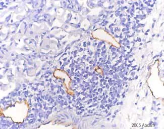 Immunohistochemistry (Formalin/PFA-fixed paraffin-embedded sections) - Anti-LYVE1 antibody - BSA and Azide free (AB14917)