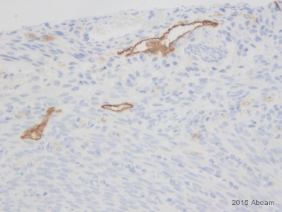 Immunohistochemistry (Formalin/PFA-fixed paraffin-embedded sections) - Anti-LYVE1 antibody - BSA and Azide free (AB14917), expandable thumbnail