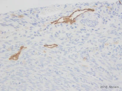 Immunohistochemistry (Formalin/PFA-fixed paraffin-embedded sections) - Anti-LYVE1 antibody - BSA and Azide free (AB14917)