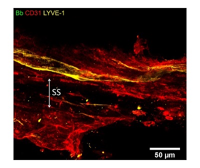 Immunohistochemistry (Formalin/PFA-fixed paraffin-embedded sections) - Anti-LYVE1 antibody - BSA and Azide free (AB14917), expandable thumbnail