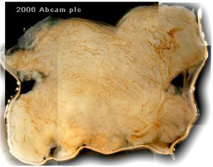 Immunohistochemistry (Formalin/PFA-fixed paraffin-embedded sections) - Anti-LYVE1 antibody - BSA and Azide free (ab14917), expandable thumbnail