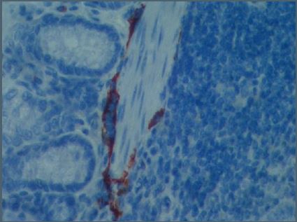 Immunohistochemistry (Formalin/PFA-fixed paraffin-embedded sections) - Anti-LYVE1 antibody - BSA and Azide free (AB14917), expandable thumbnail
