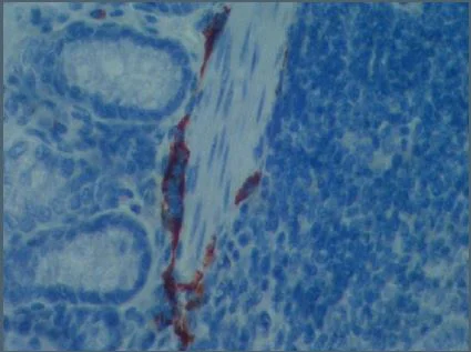 Immunohistochemistry (Formalin/PFA-fixed paraffin-embedded sections) - Anti-LYVE1 antibody - BSA and Azide free (AB14917)