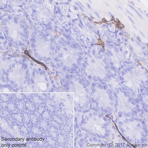 Immunohistochemistry (Formalin/PFA-fixed paraffin-embedded sections) - Anti-LYVE1 antibody [EPR21771] (AB218535), expandable thumbnail