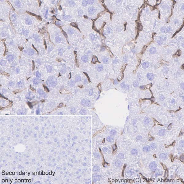 Immunohistochemistry (Formalin/PFA-fixed paraffin-embedded sections) - Anti-LYVE1 antibody [EPR21771] (ab218535), expandable thumbnail