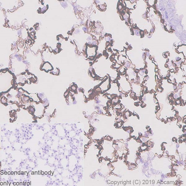 Immunohistochemistry (Formalin/PFA-fixed paraffin-embedded sections) - Anti-LYVE1 antibody [EPR21771] (AB218535), expandable thumbnail