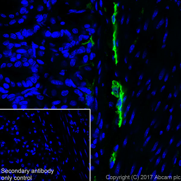 Immunohistochemistry (Frozen sections) - Anti-LYVE1 antibody [EPR21771] (AB218535), expandable thumbnail