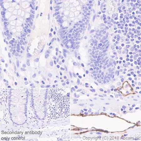 Immunohistochemistry (Formalin/PFA-fixed paraffin-embedded sections) - Anti-LYVE1 antibody [EPR21857] (AB219556)