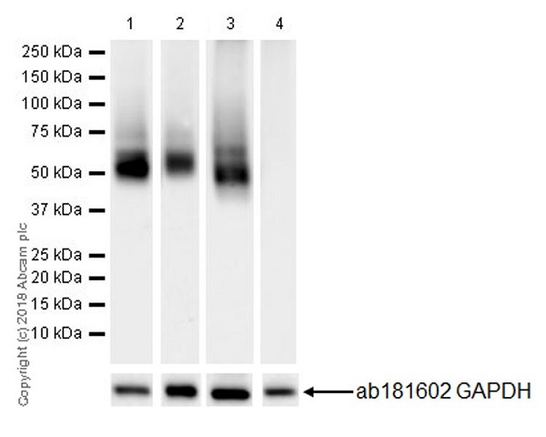 Western blot - Anti-LYVE1 antibody [EPR21857] (AB219556), expandable thumbnail