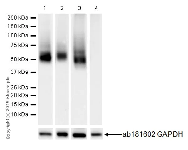 Western blot - Anti-LYVE1 antibody [EPR21857] (AB219556)
