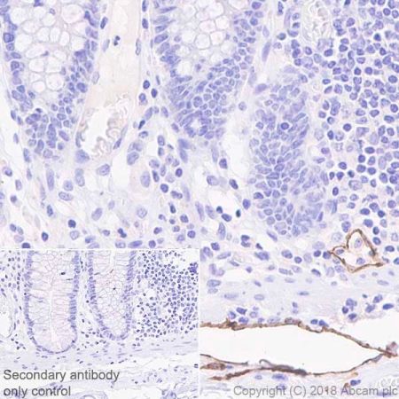 Immunohistochemistry (Formalin/PFA-fixed paraffin-embedded sections) - Anti-LYVE1 antibody [EPR21857] - BSA and Azide free (AB232935), expandable thumbnail