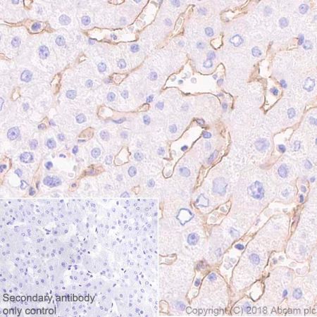 Immunohistochemistry (Formalin/PFA-fixed paraffin-embedded sections) - Anti-LYVE1 antibody [EPR21857] - BSA and Azide free (AB232935), expandable thumbnail