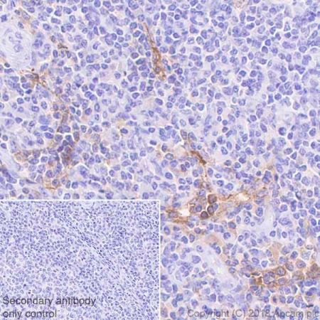 Immunohistochemistry (Formalin/PFA-fixed paraffin-embedded sections) - Anti-LYVE1 antibody [EPR21857] - BSA and Azide free (AB232935), expandable thumbnail