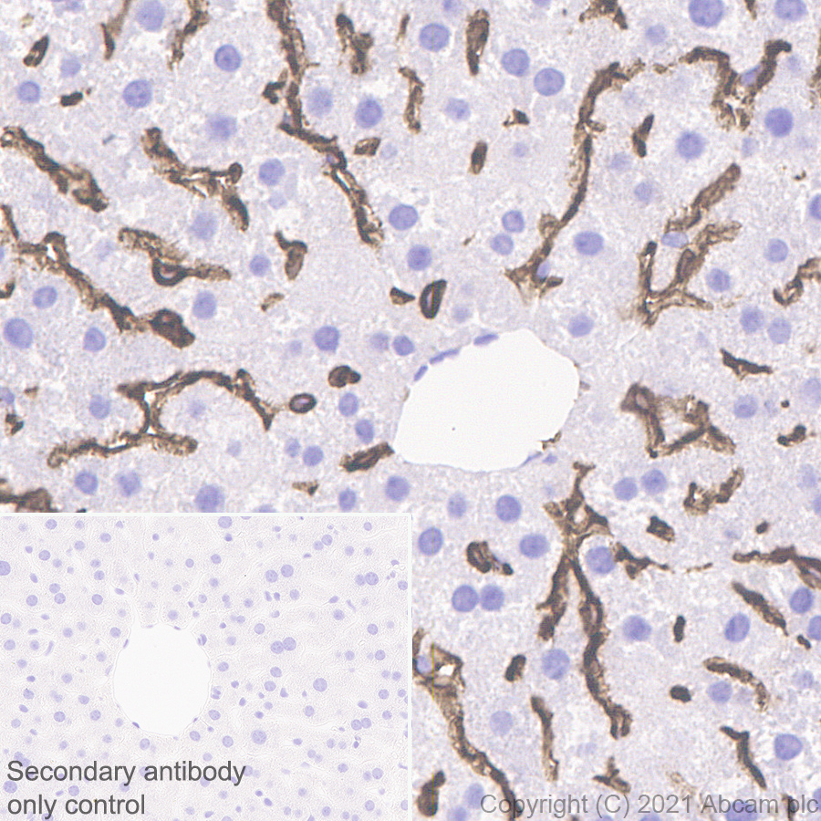 Immunohistochemistry (Formalin/PFA-fixed paraffin-embedded sections) - Anti-LYVE1 antibody [RM1008] (AB281587), expandable thumbnail