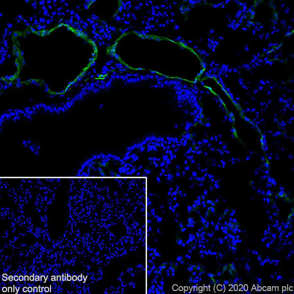 Immunohistochemistry (Frozen sections) - Anti-LYVE1 antibody [RM1008] (AB281587)