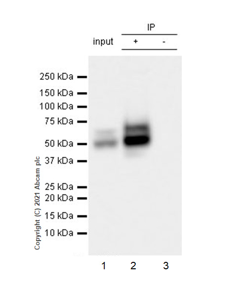 Immunoprecipitation - Anti-LYVE1 antibody [RM1008] (ab281587), expandable thumbnail