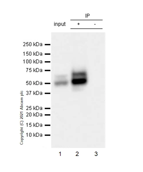 Immunoprecipitation - Anti-LYVE1 antibody [RM1008] (AB281587)
