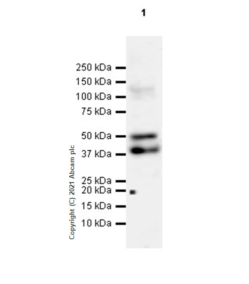 Western blot - Anti-LYVE1 antibody [RM1008] (AB281587), expandable thumbnail