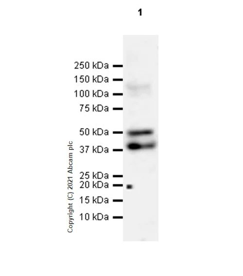 Western blot - Anti-LYVE1 antibody [RM1008] (AB281587)